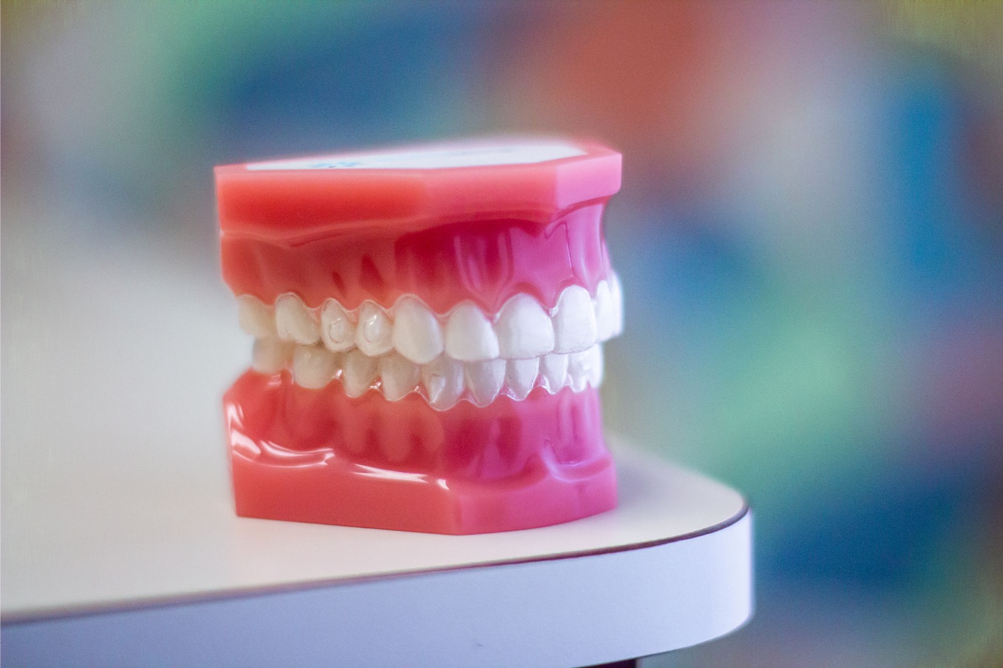 IMG_5783 Clear aligners on a mold